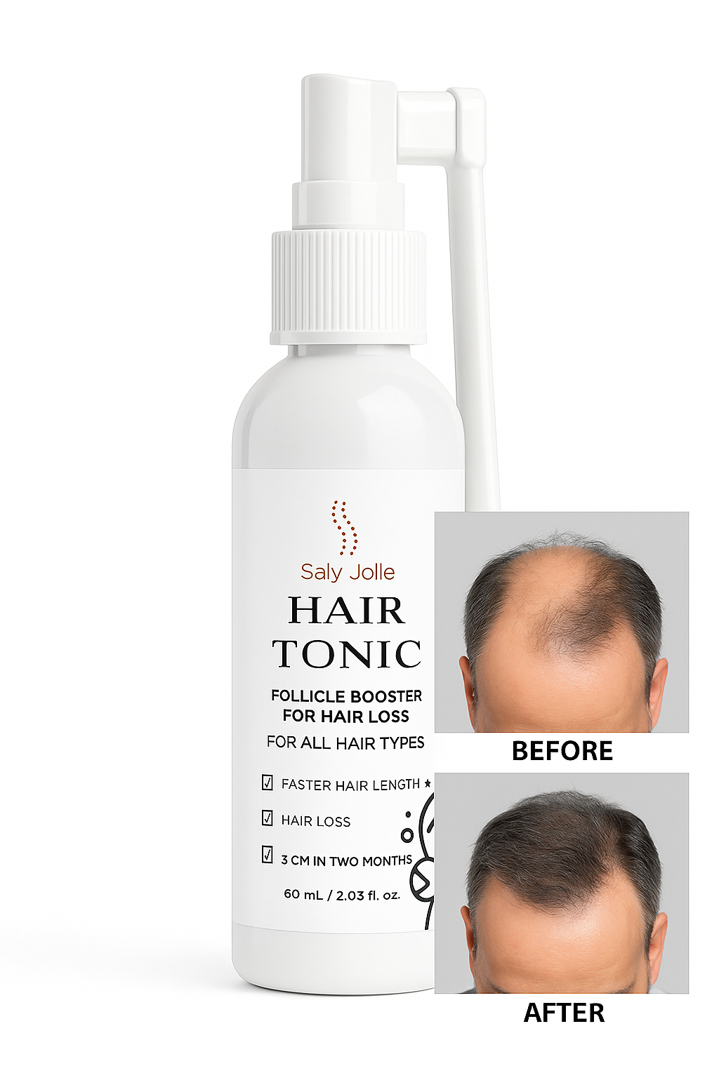 Yildiz Hair Loss Follicle Booster, 60ml