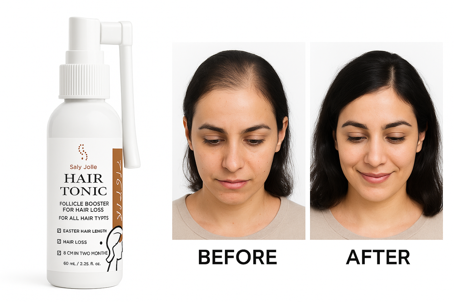 Yildiz Hair Loss Follicle Booster, 60ml
