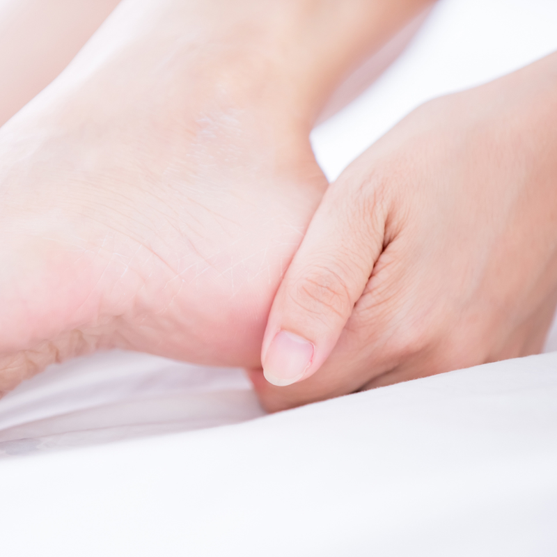 كريم اليوريا 15% للقدمين وتقرن الشعر