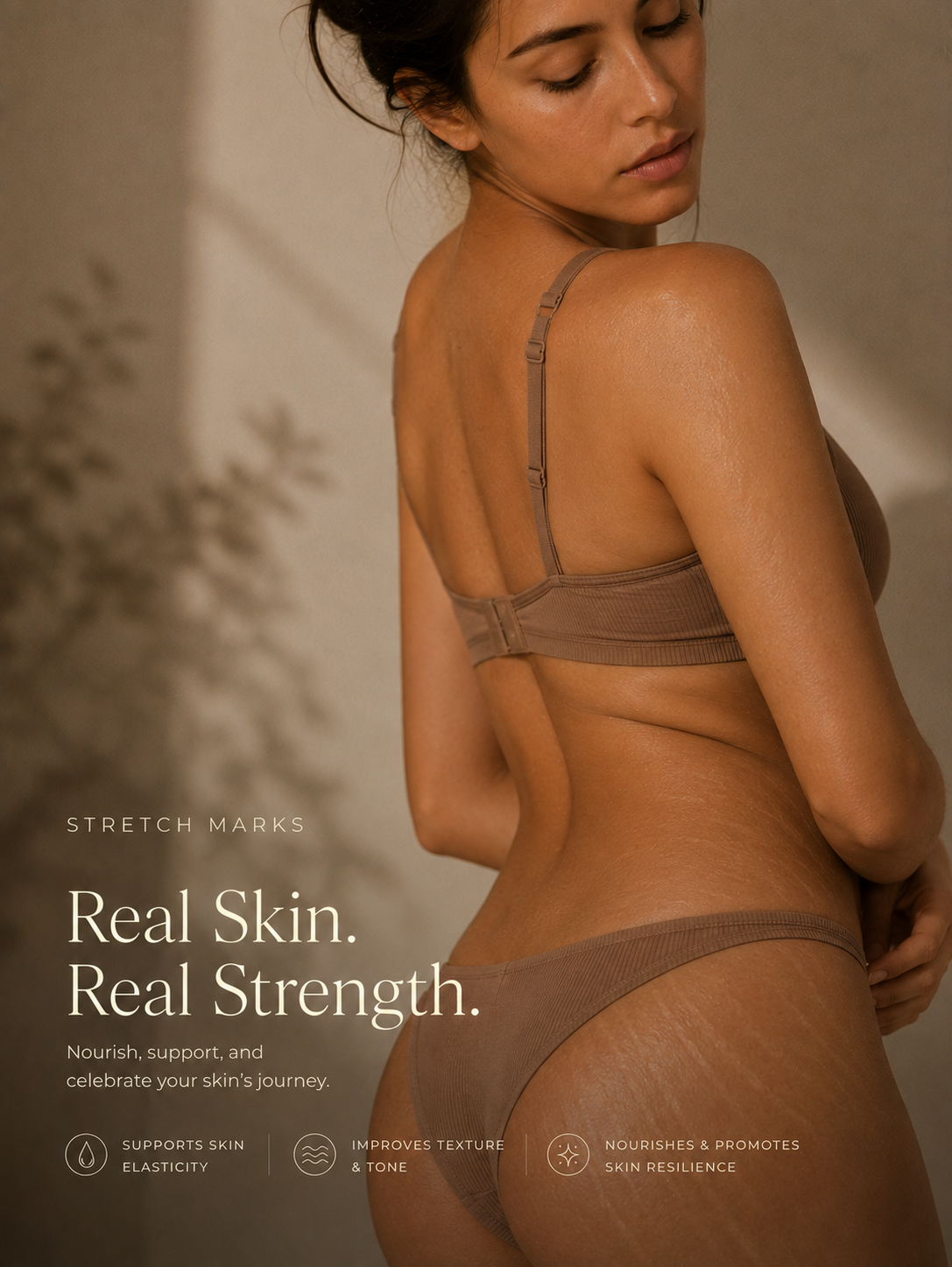 Stretch Marks