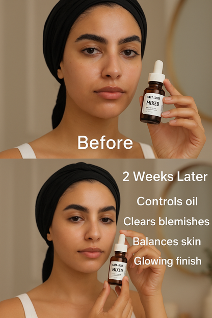 Mixed oils - oily & combination, 15ml