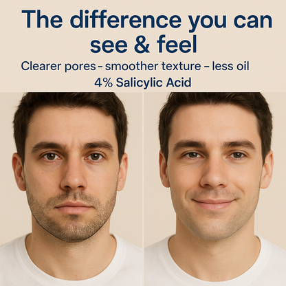 تونر BHA بحمض الساليسيليك 4%