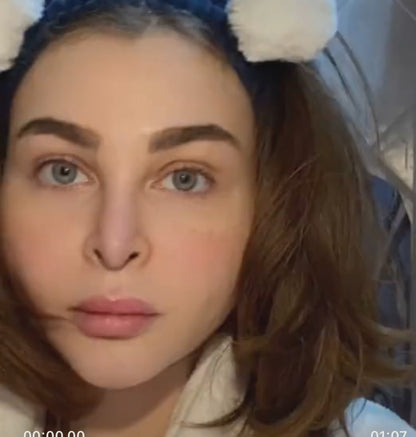 9% Niacinamide Vitamin B3 Cream 150gm